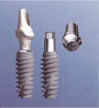  NobelActive internal and external implant systems